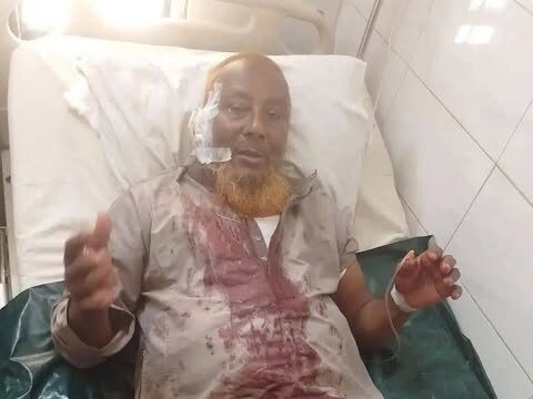 নামকরা আলেম নুরুল আমিন মাদানীর ওপর মসজিদে হামলা: চাপাতির কোপে গুরুতর আহত